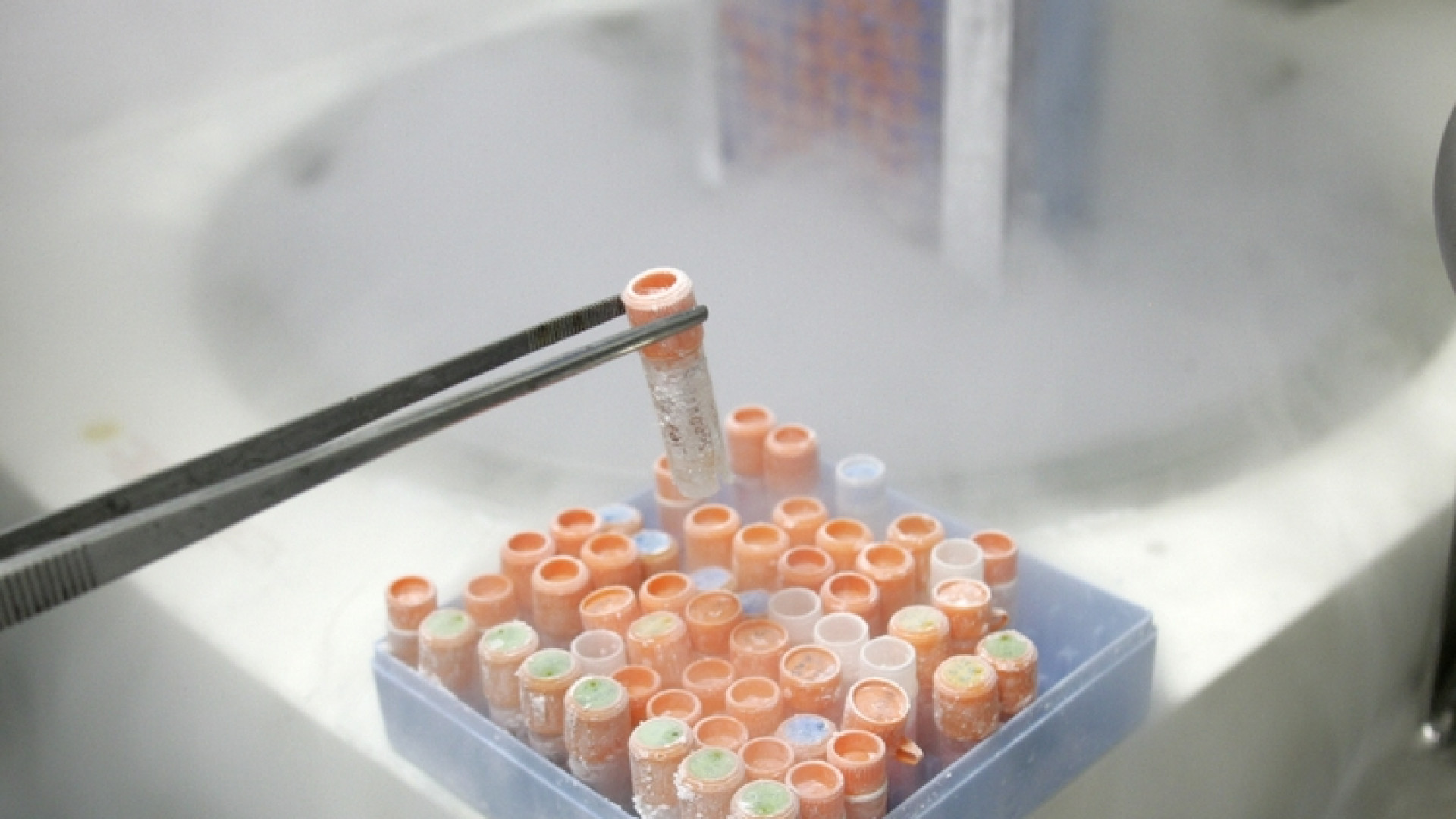 Immagine di Test sull’embrione e il limite di 14 giorni