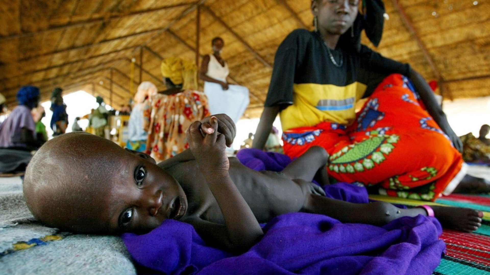 Immagine di Denutrizione prima malattia dei bimbi in Niger