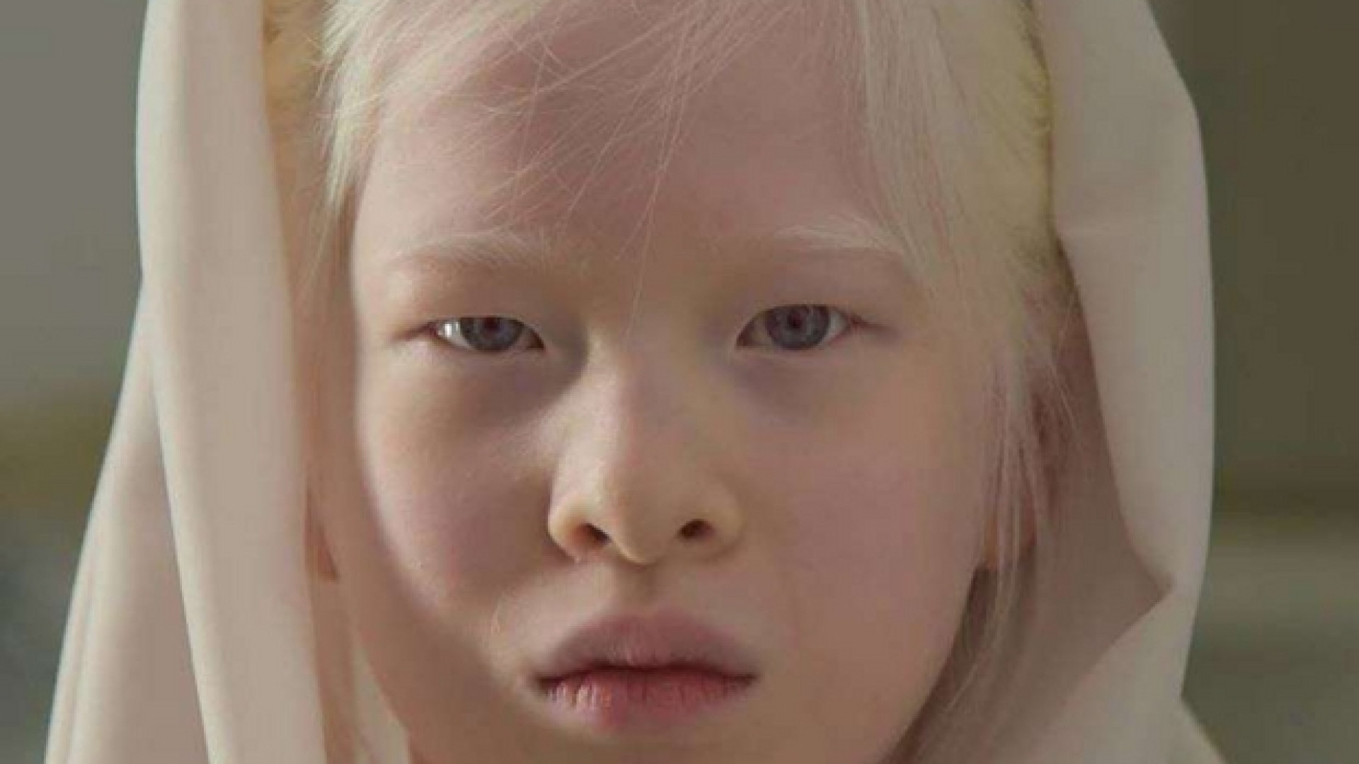 Immagine di Xueli, la bambina albina abbandonata diventa modella