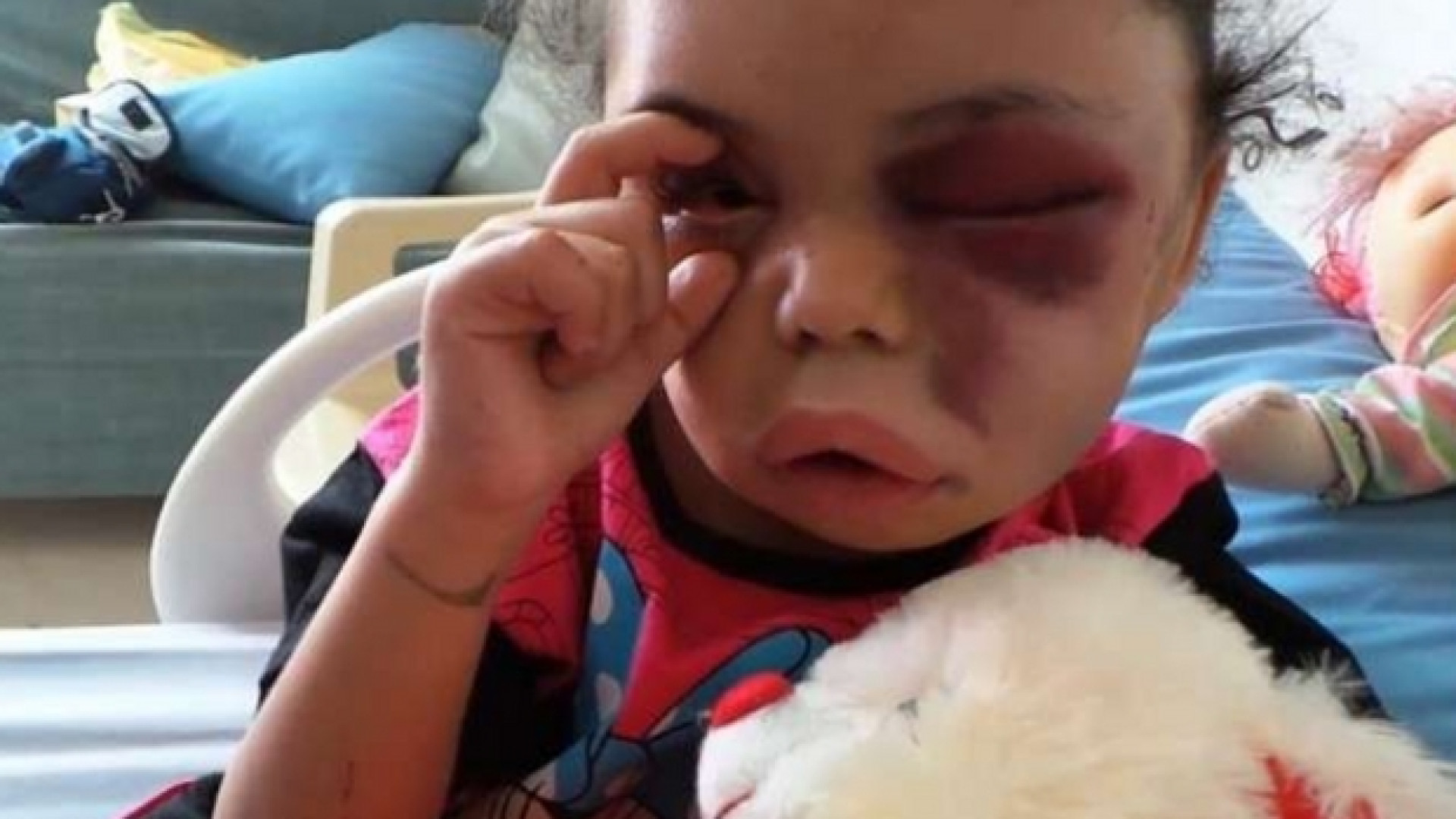 Immagine di La piccola che apre gli occhi al mondo sulla guerra in Yemen