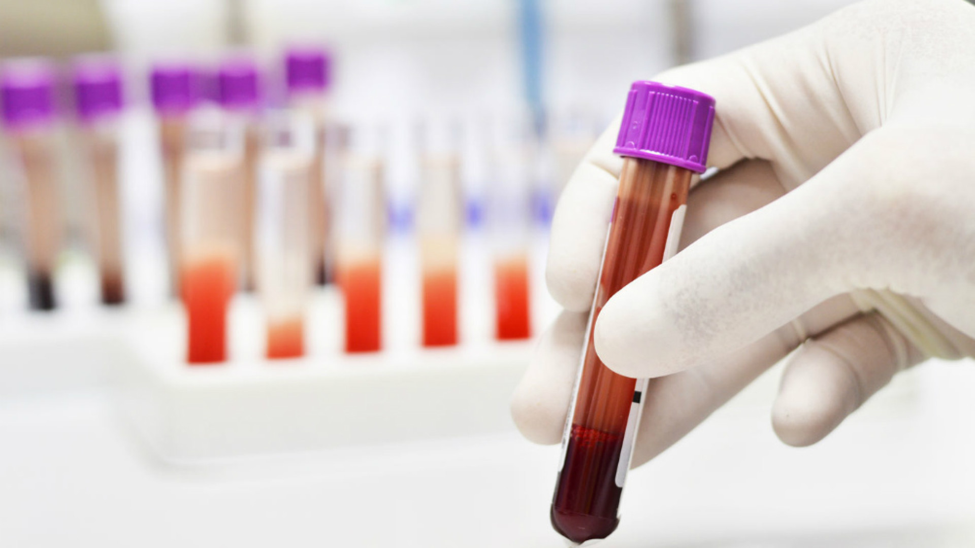 Immagine di Il Dr. Paolo Ricci: «Tumori, è meglio diffidare delle cure alternative»