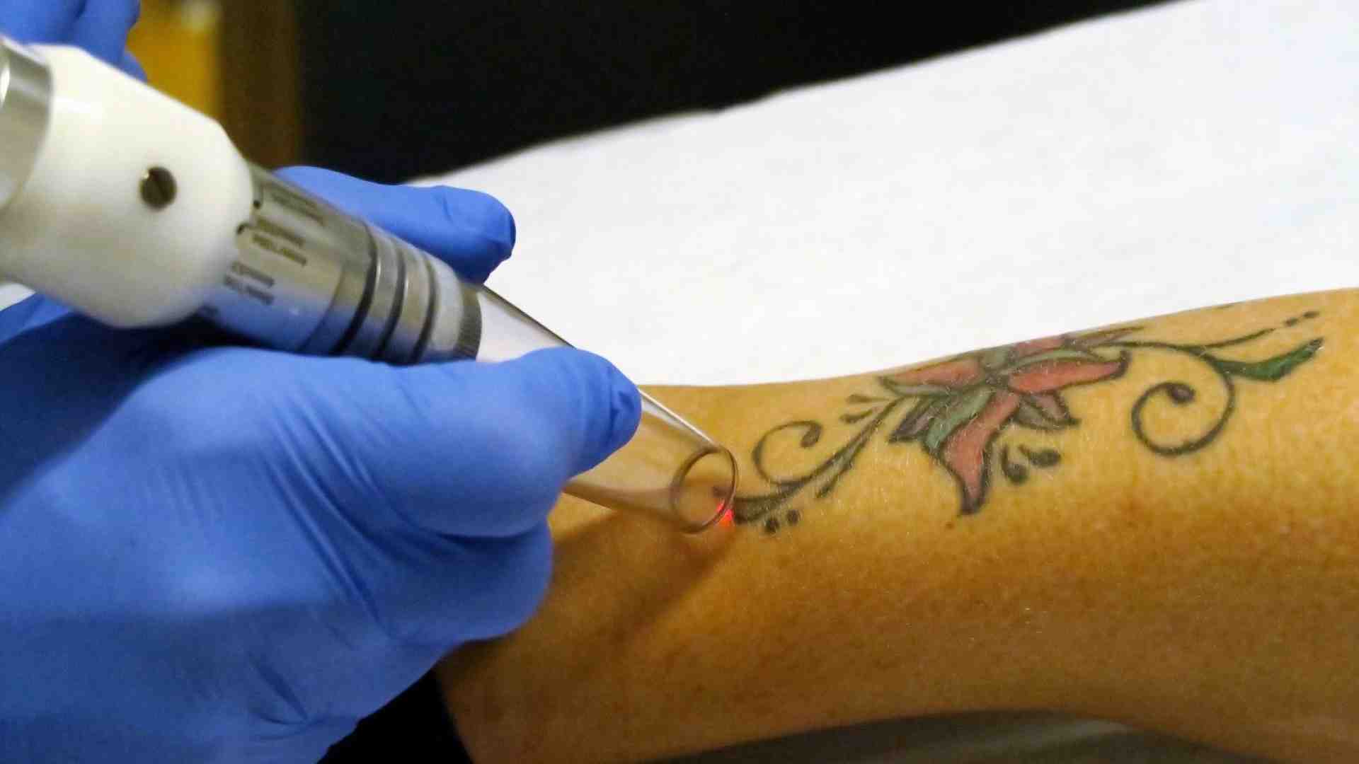Immagine di La mania dei tatuaggi è... irreversibile