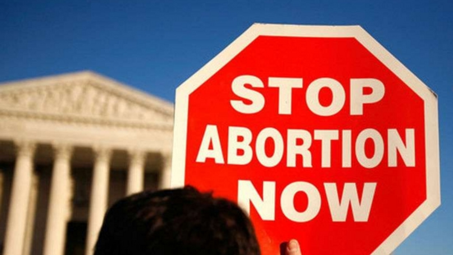 Immagine di Ecco l'America dell'«aborto tardivo»