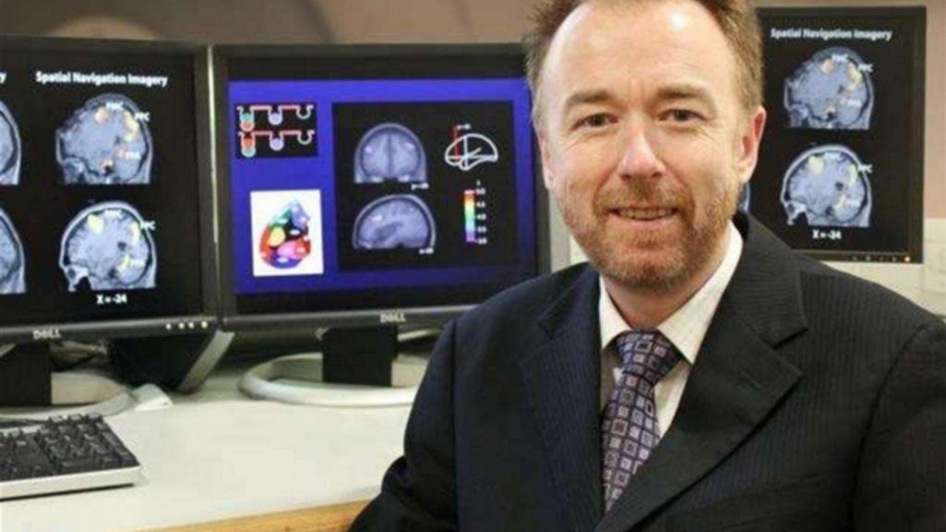 Immagine di Owen: ogni individuo è diverso, serve prudenza a staccare il sondino