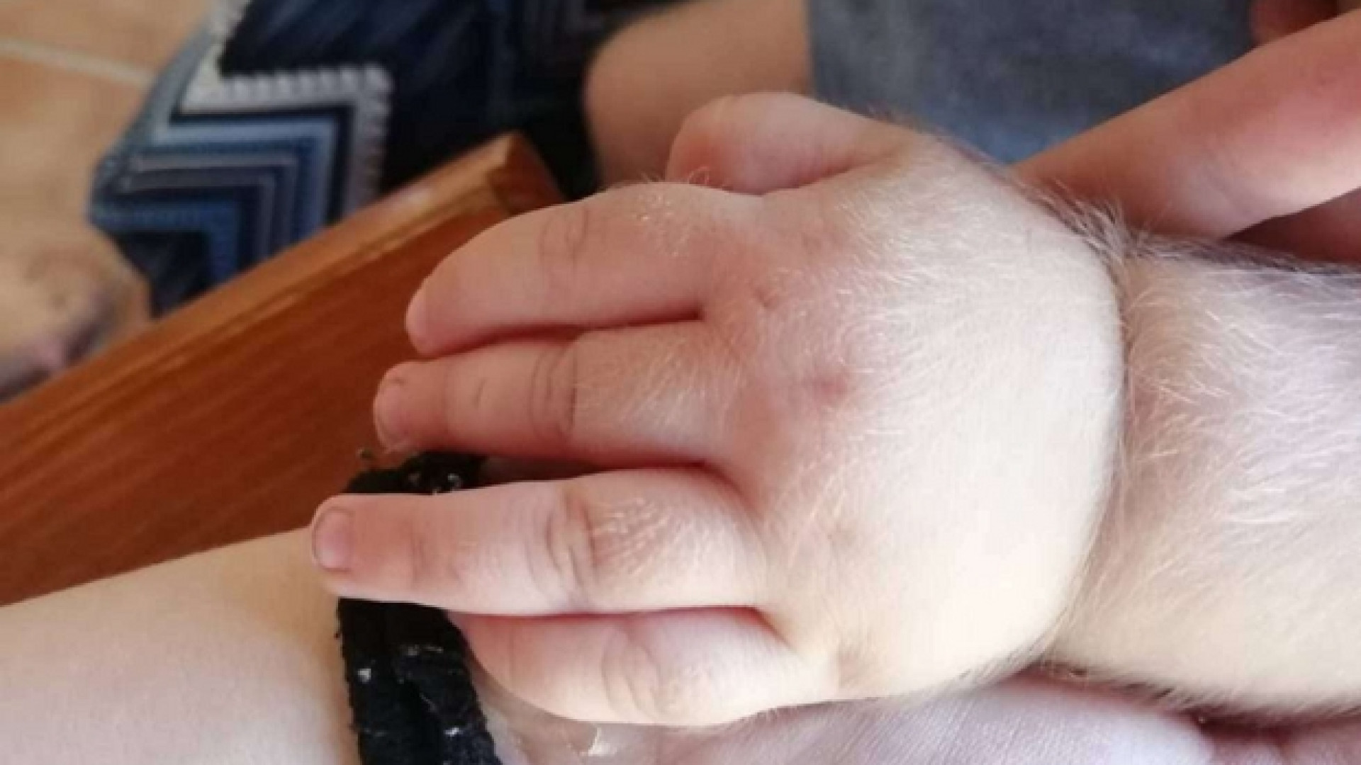 Immagine di La sindrome del lupo colpisce 17 bimbi per un errore della casa farmaceutica