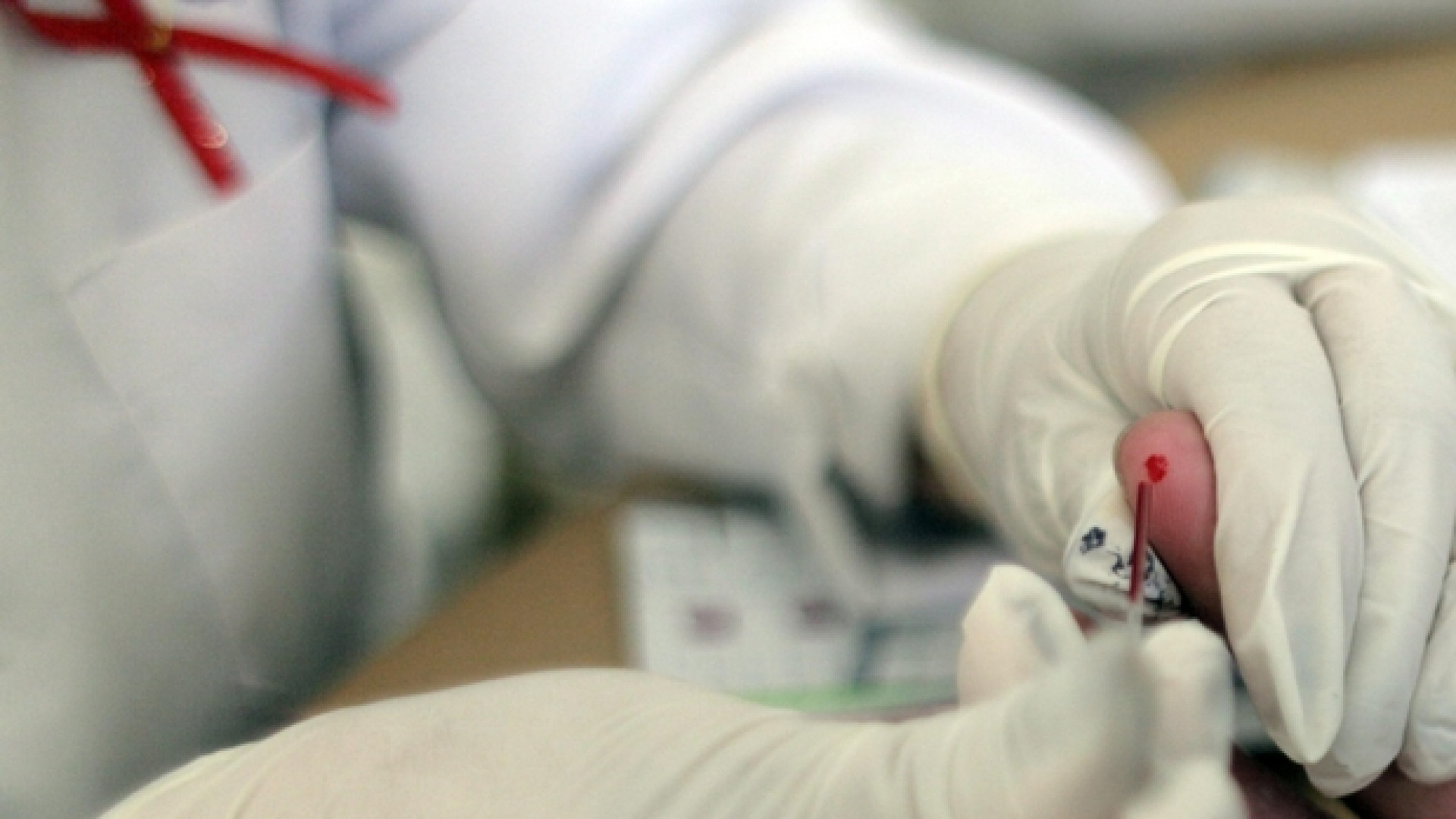 Immagine di Giovane ricercatrice contagiata in laboratorio da virus dell'Hiv