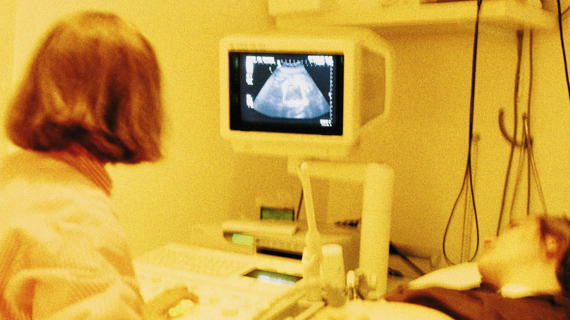 Immagine di Aborti al minimo, crescono Ru486 e obiezione di coscienza