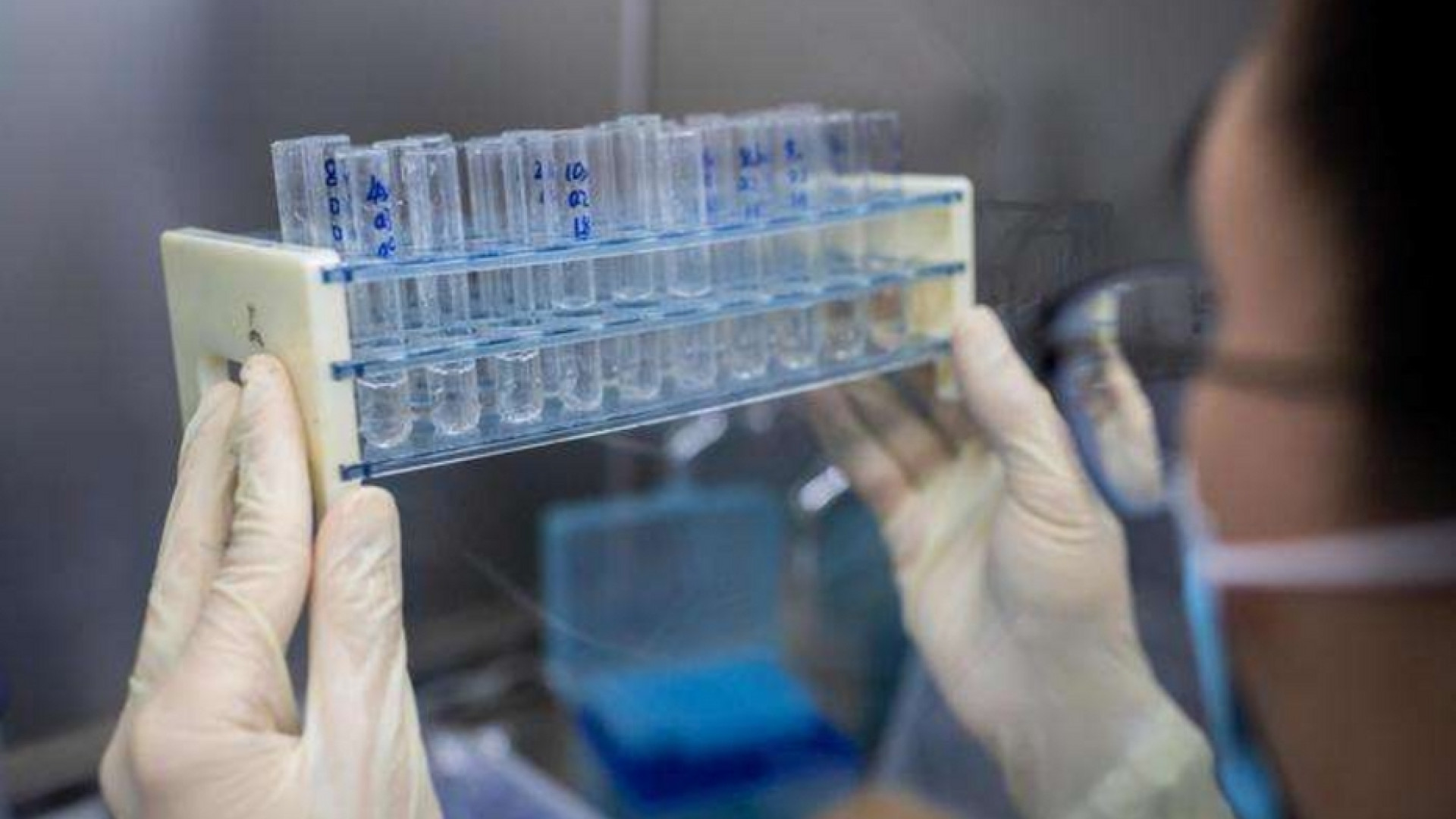 Immagine di La Cina ha brevettato il suo primo vaccino contro il coronavirus