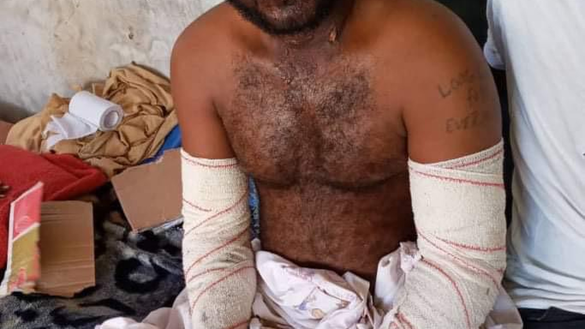 Immagine di Ustionati in mare, la Libia li lascia "liberi". In carcere i sani
