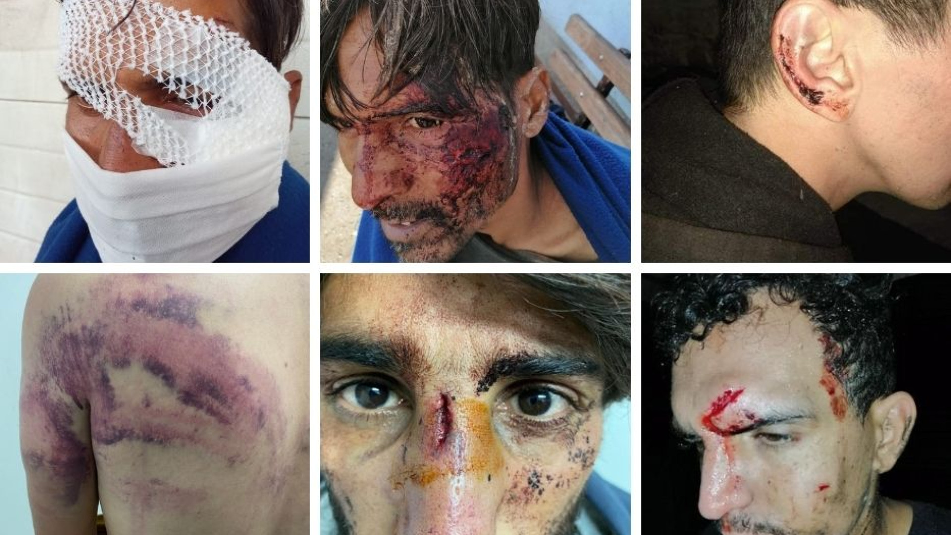Immagine di Sulla rotta balcanica delle migrazionI