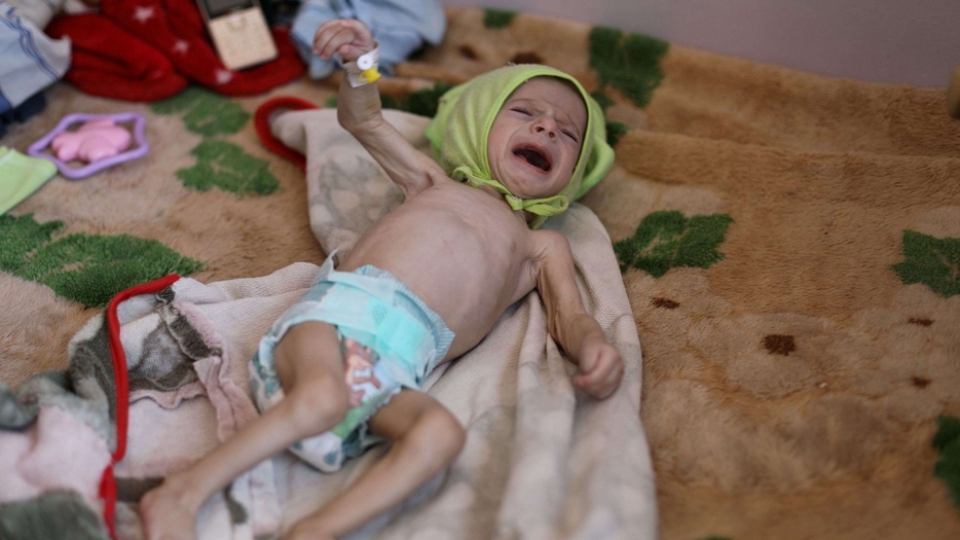 Immagine di Yemen, rischio malnutrizione cronica per metà dei bambini sotto i 5 anni