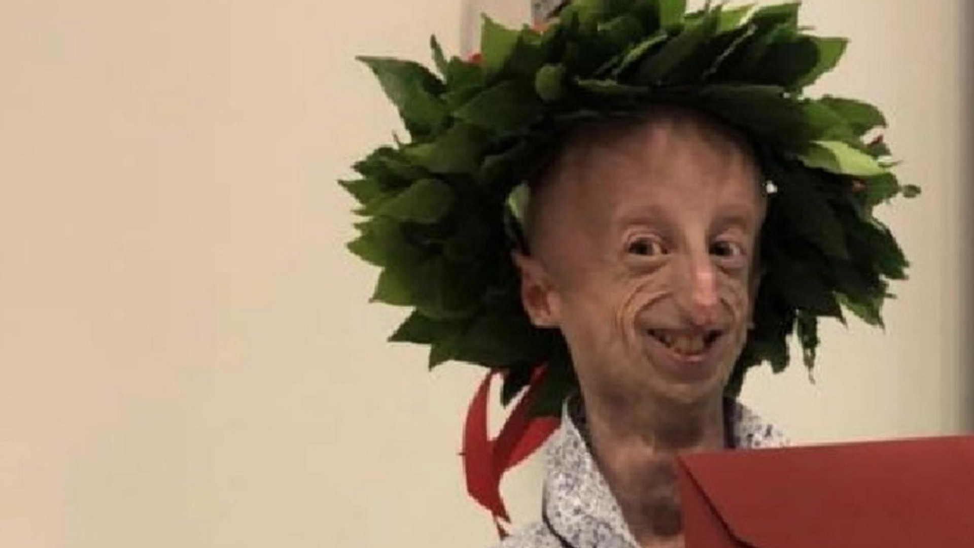 Immagine di Seconda laurea per Sammy Basso, affetto da progeria