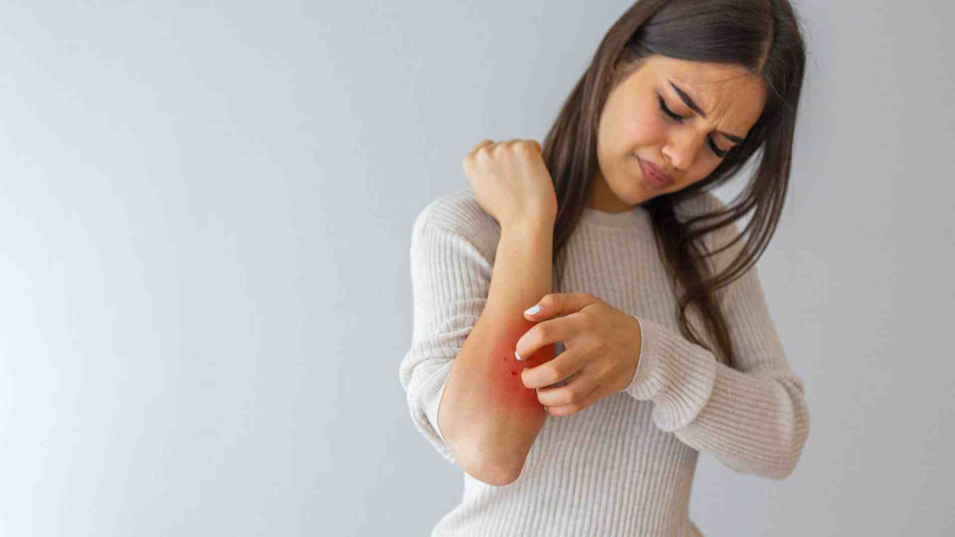Immagine di Maledetta psoriasi disturba più la mente che la pelle