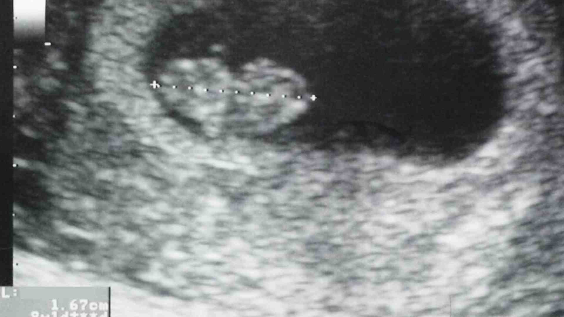 Immagine di Aborto, sul battito del feto una polemica elettorale