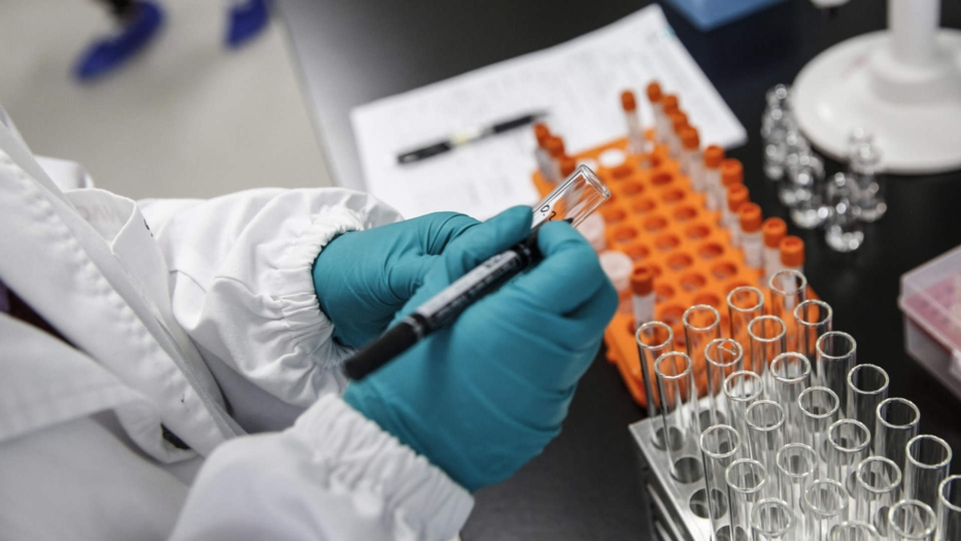 Immagine di Così una "spia" rivelerà il cancro del polmone in tempo per guarire
