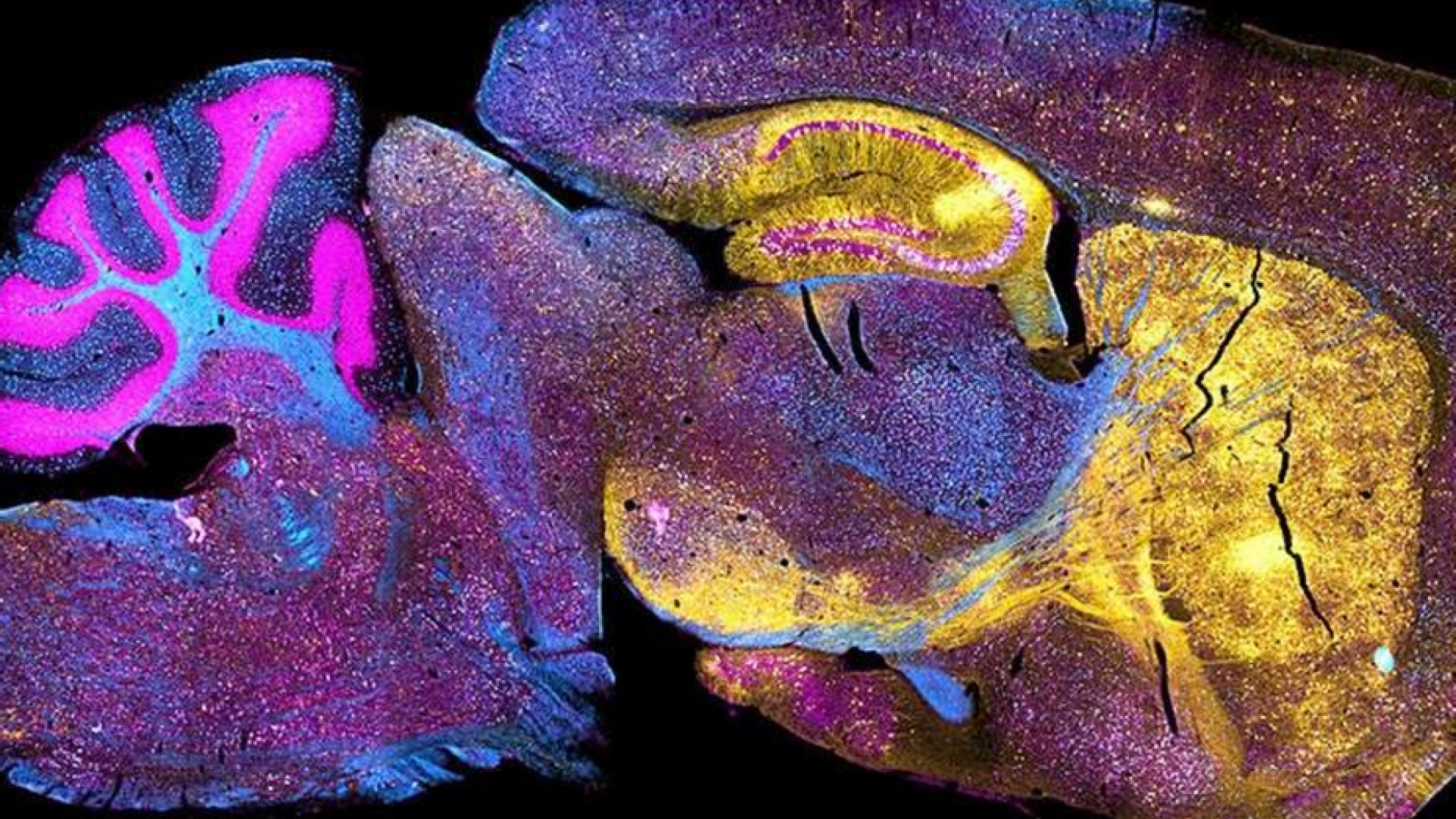 Immagine di Chimere e organoidi che giocano: così si studia il cervello (con dubbi etici)