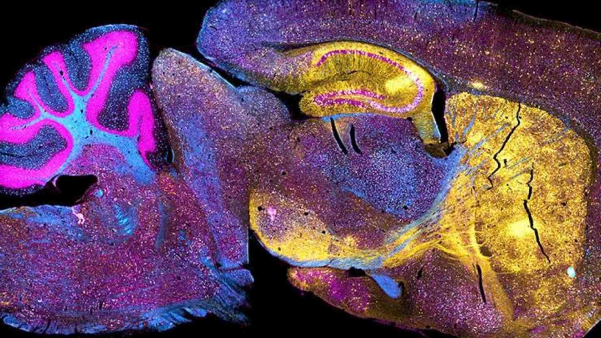 Immagine di Chimere e organoidi che giocano: così si studia il cervello (con dubbi etici)