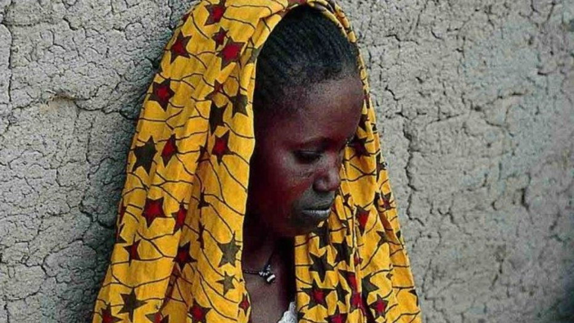 Immagine di Il Papa: non scartiamo i malati di lebbra, costruiamo una società inclusiva