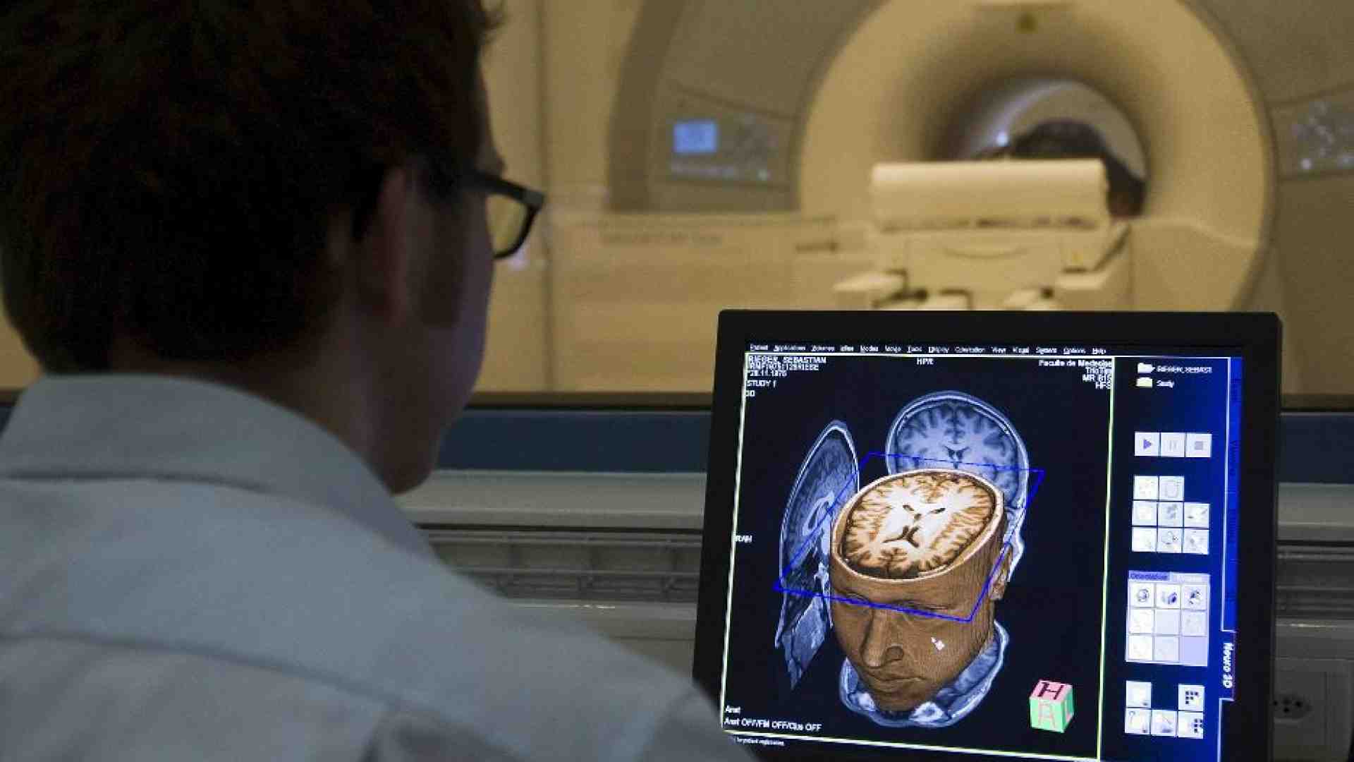 Immagine di Malato di Sla parla grazie a un lettore collocato nel cervello
