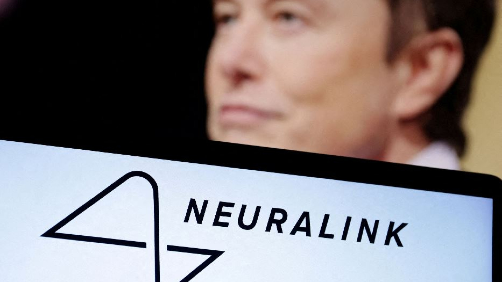 Immagine di Un'azienda di Musk autorizzata a impiantare chip nel cervello
