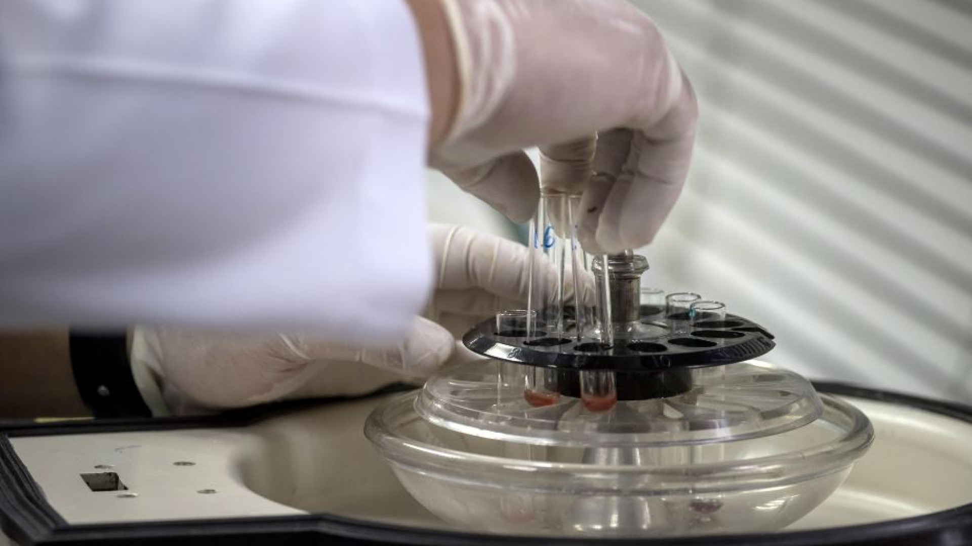 Immagine di Creato in laboratorio uno pseudo-embrione umano sintetico, un salto nel vuoto?