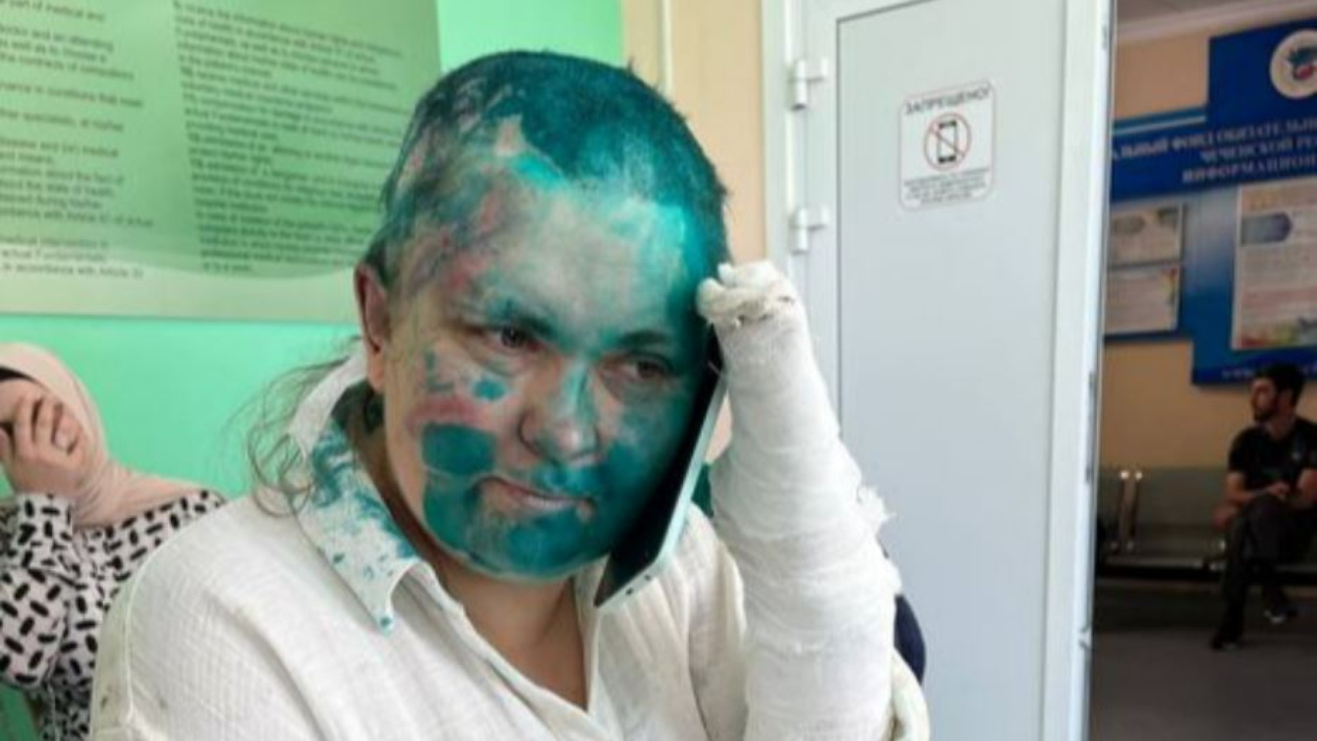 Immagine di Pestata in Cecenia giornalista di Novaya Gazeta. È l'erede di Politkovsaja