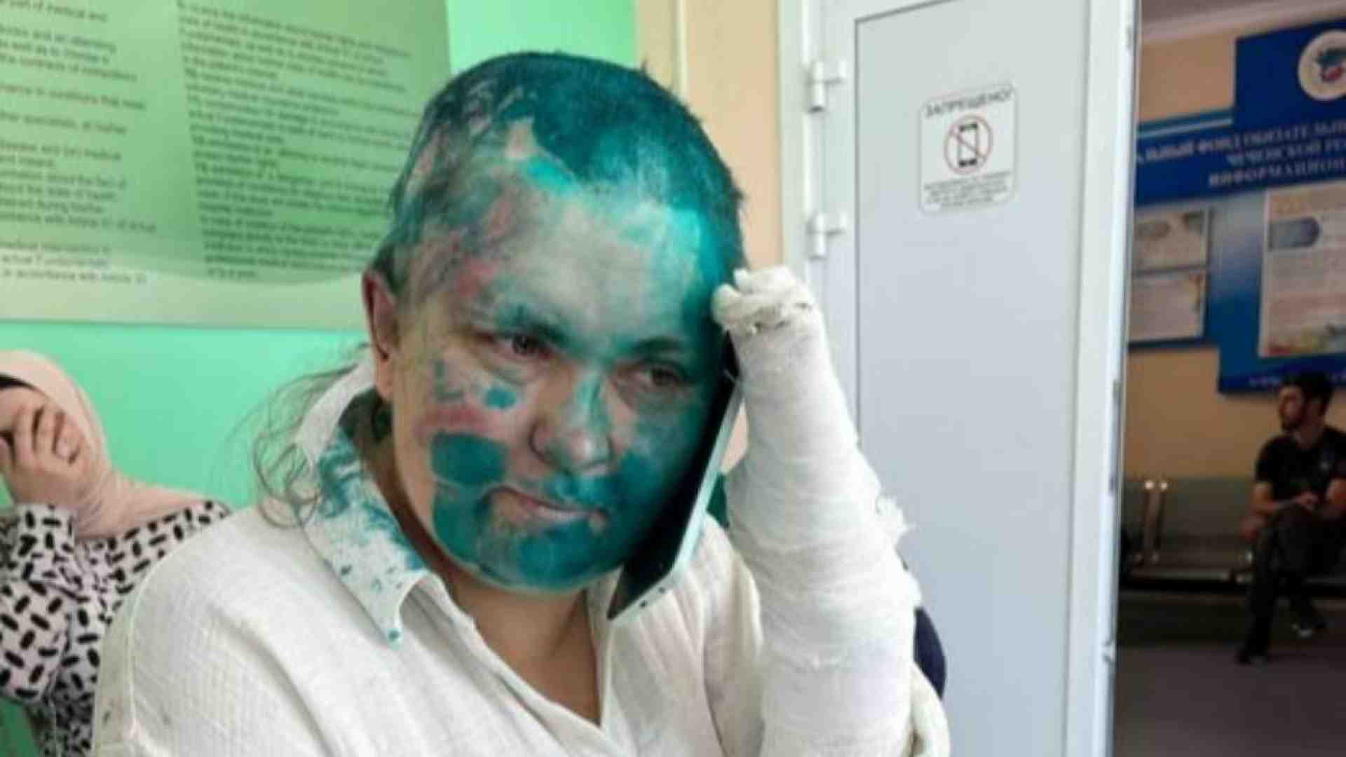 Immagine di Pestata in Cecenia giornalista di Novaya Gazeta. È l'erede di Politkovsaja