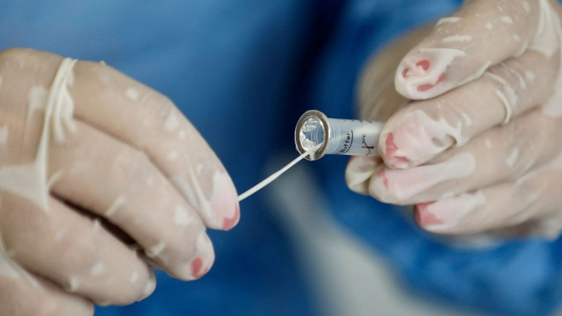 Immagine di Covid, +44% di casi in 7 giorni. Tornano i tamponi in pronto soccorso