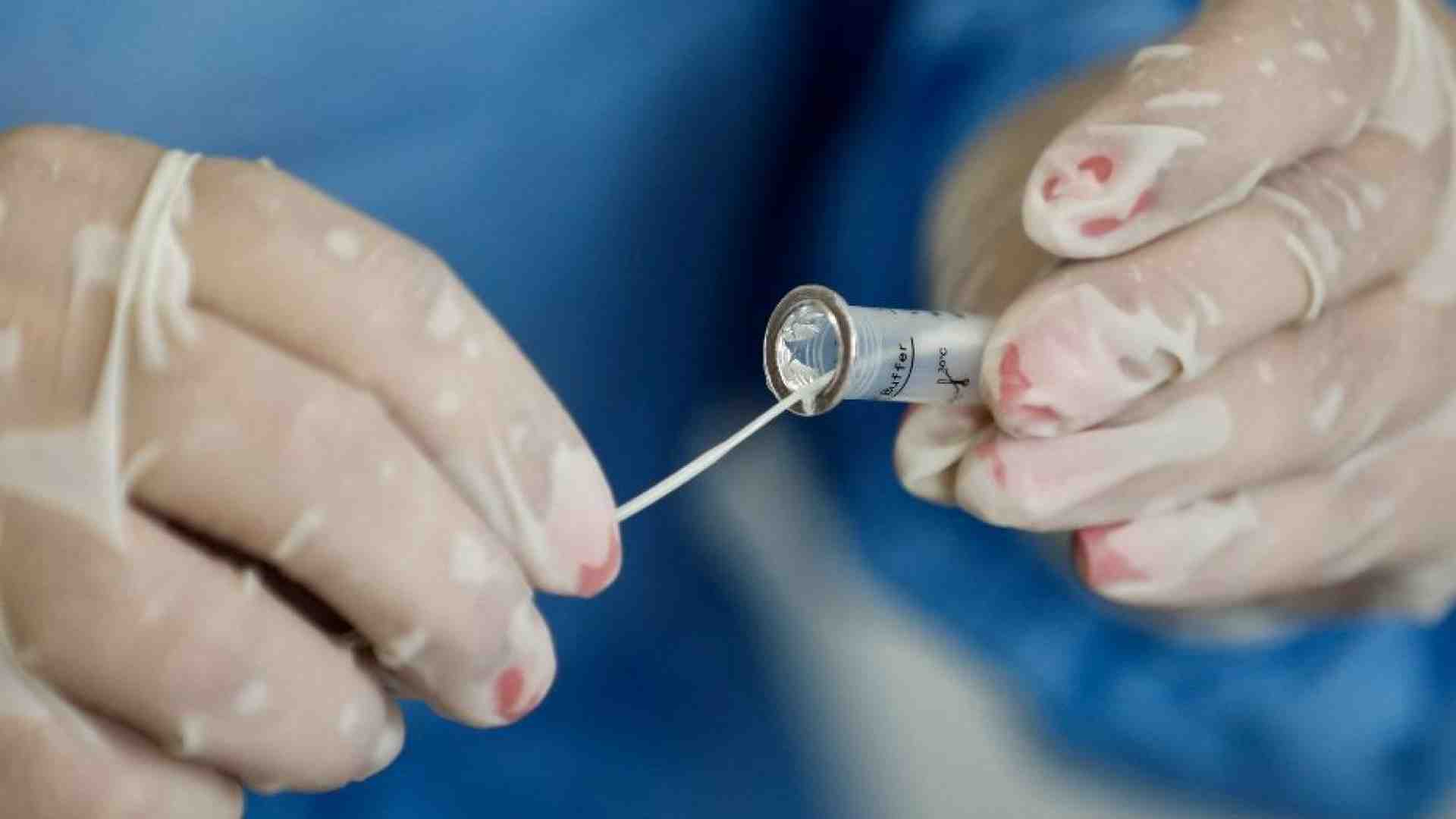 Immagine di Covid, +44% di casi in 7 giorni. Tornano i tamponi in pronto soccorso