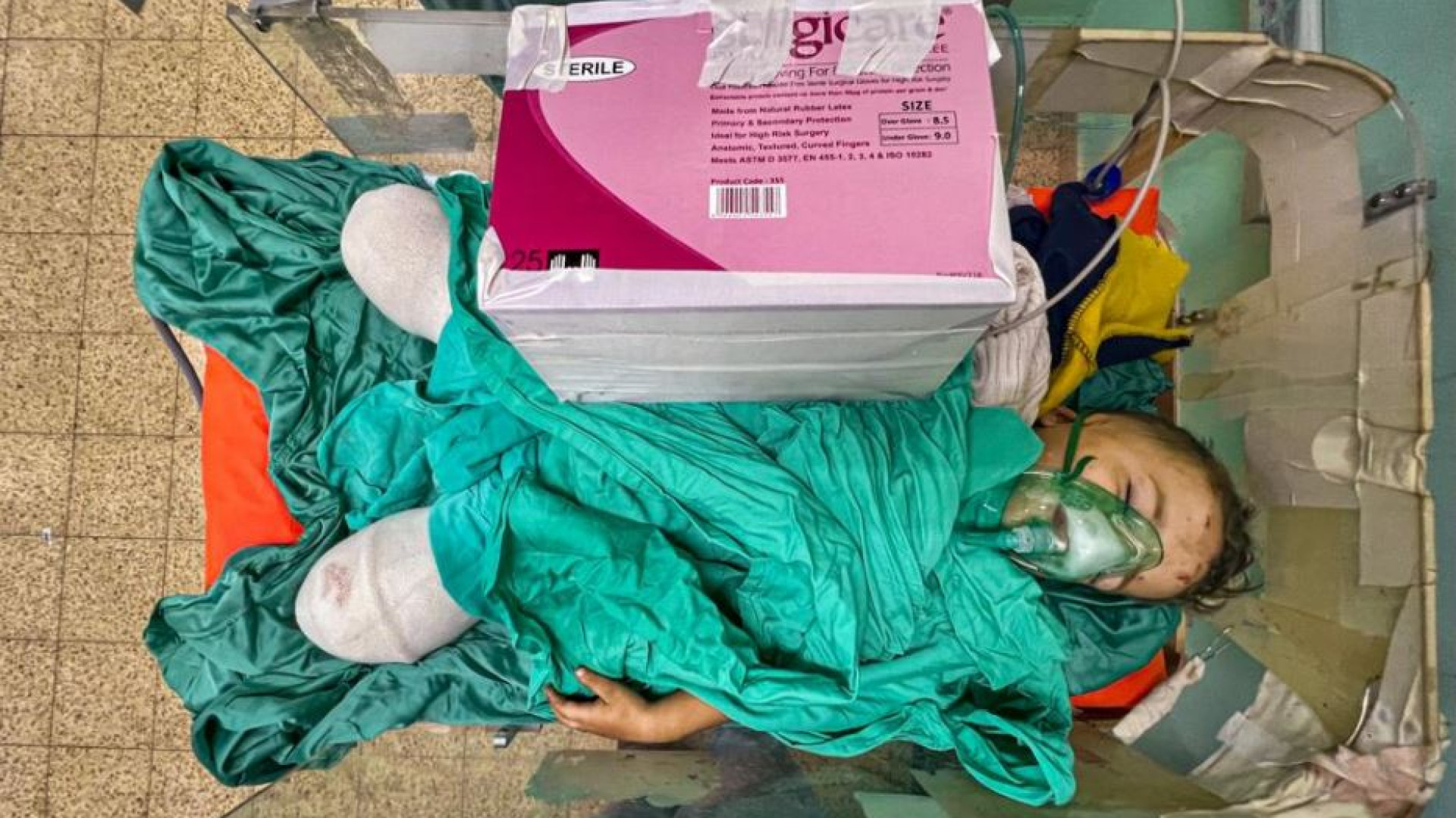 Immagine di La tragedia di Gaza nella foto del bambino con le gambe amputate
