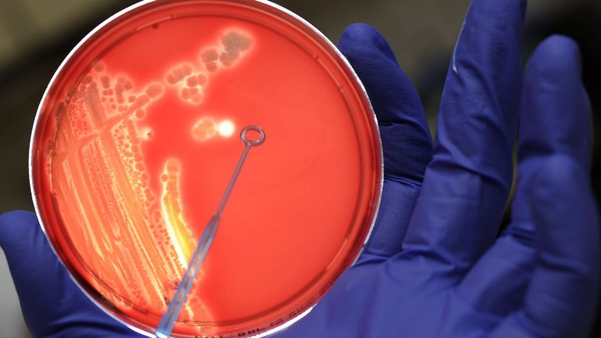 Immagine di Un nuovo antibiotico contro il batterio killer