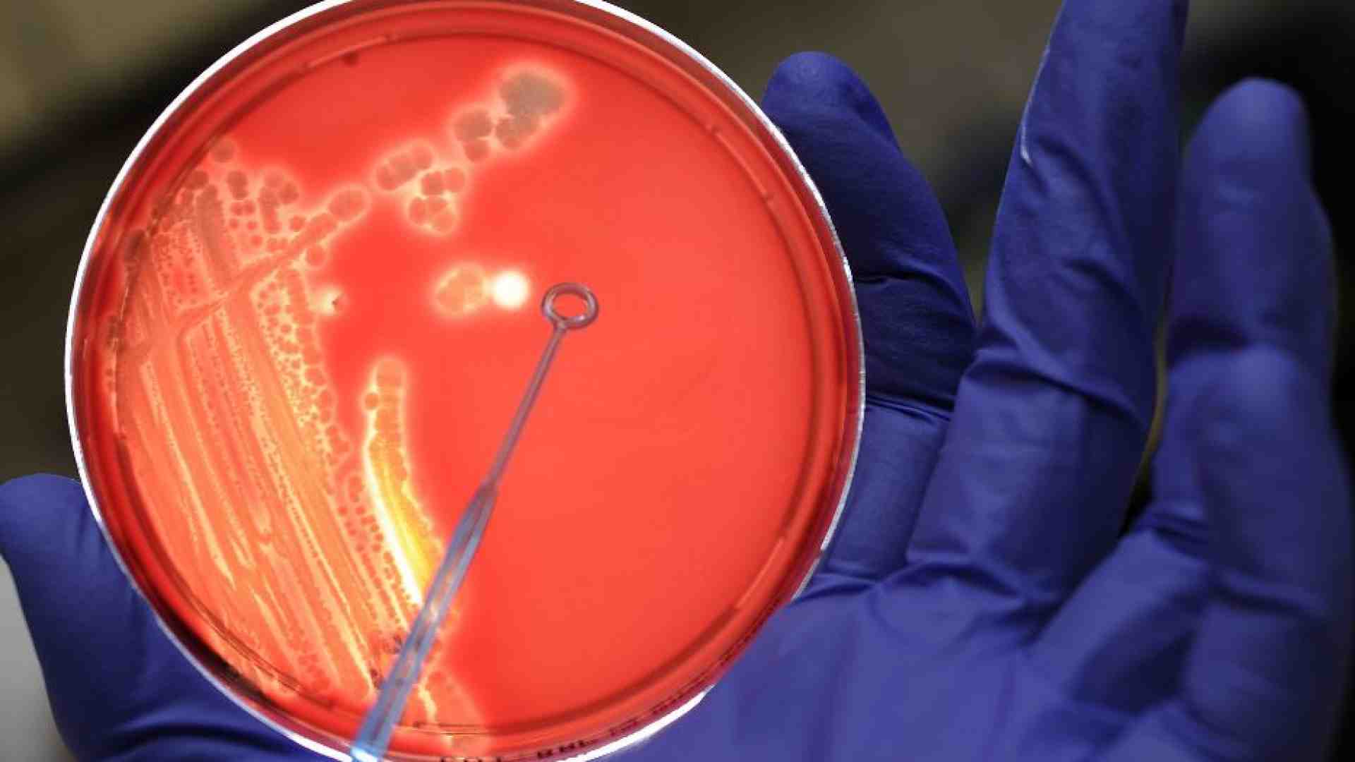 Immagine di Un nuovo antibiotico contro il batterio killer