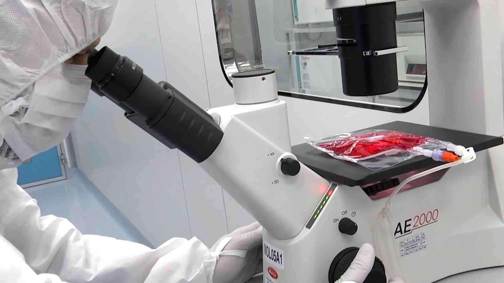 Immagine di Cellule Car-T in ragazzi con gravi malattie autoimmuni: stanno bene