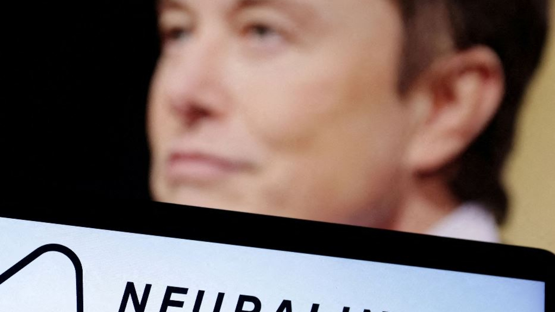 Immagine di La sfida di Musk, fare “muovere” un tetraplegico con un chip nel cervello