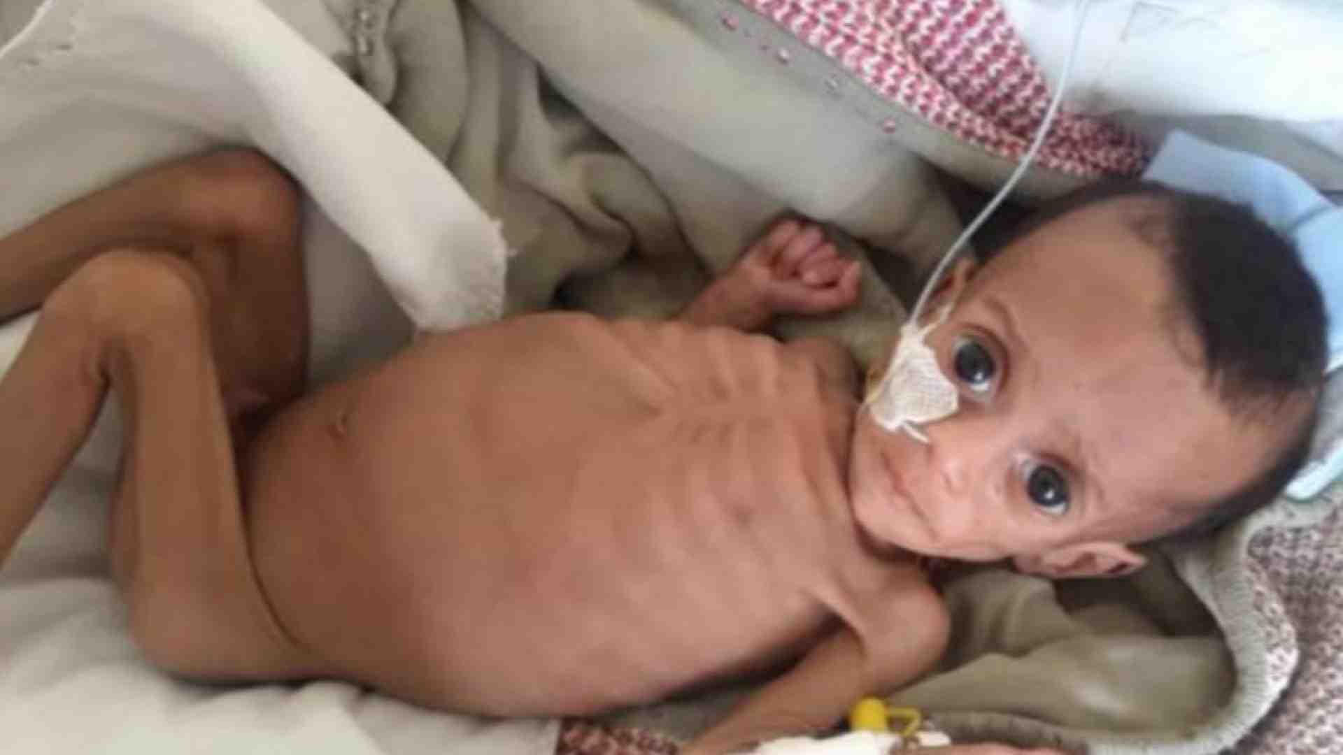 Immagine di Tigrai 2024, la fame dimenticata: così muoiono in silenzio mamme e neonati