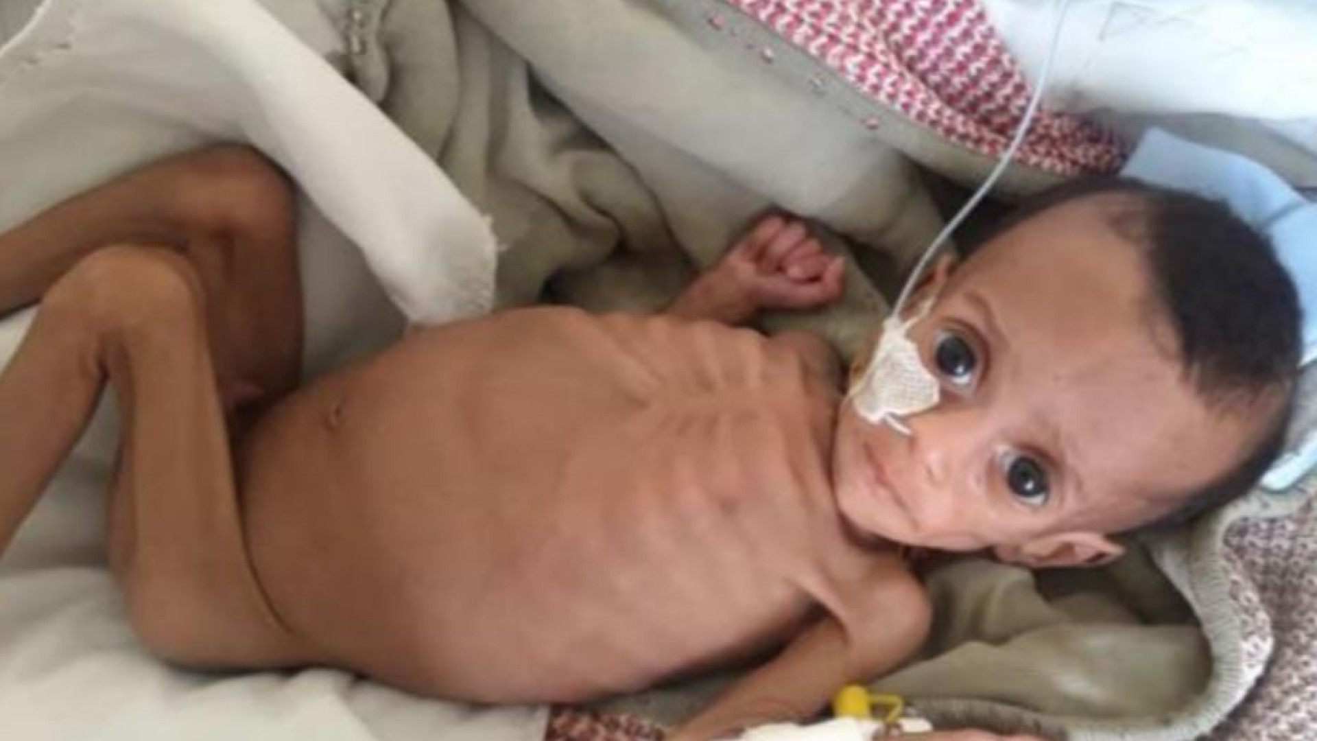 Immagine di Tigrai 2024, la fame dimenticata: così muoiono in silenzio mamme e neonati