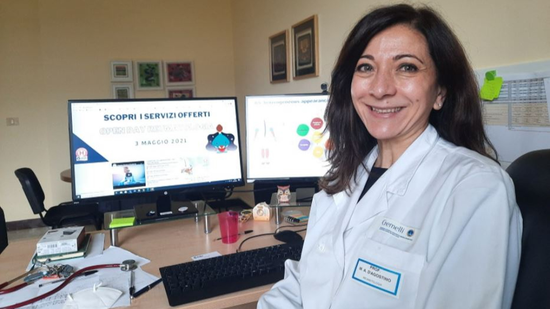 Immagine di Artrite reumatoide, la cura precoce rallenta la malattia