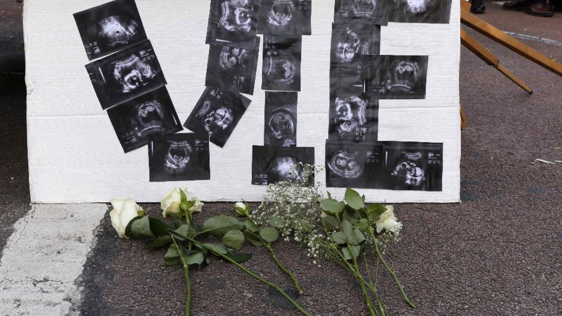 Immagine di «Diritto di aborto? 234mila interruzioni l’anno, che bisogno c’era?»