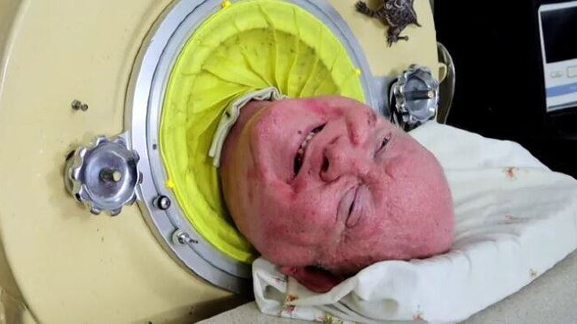 Immagine di Addio a Paul Alexander, dopo 70 anni di «vita piena» in un polmone d'acciaio