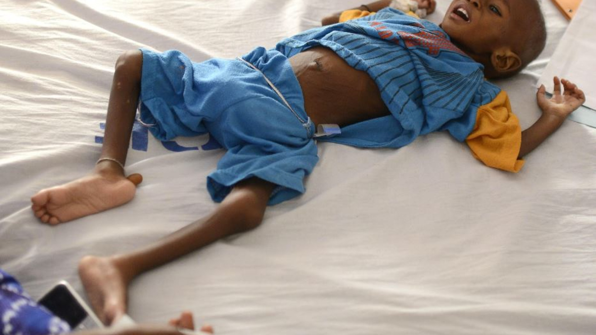 Immagine di L'Onu: il mondo ha risorse per sfamare tutti, ma uno su 10 è senza cibo