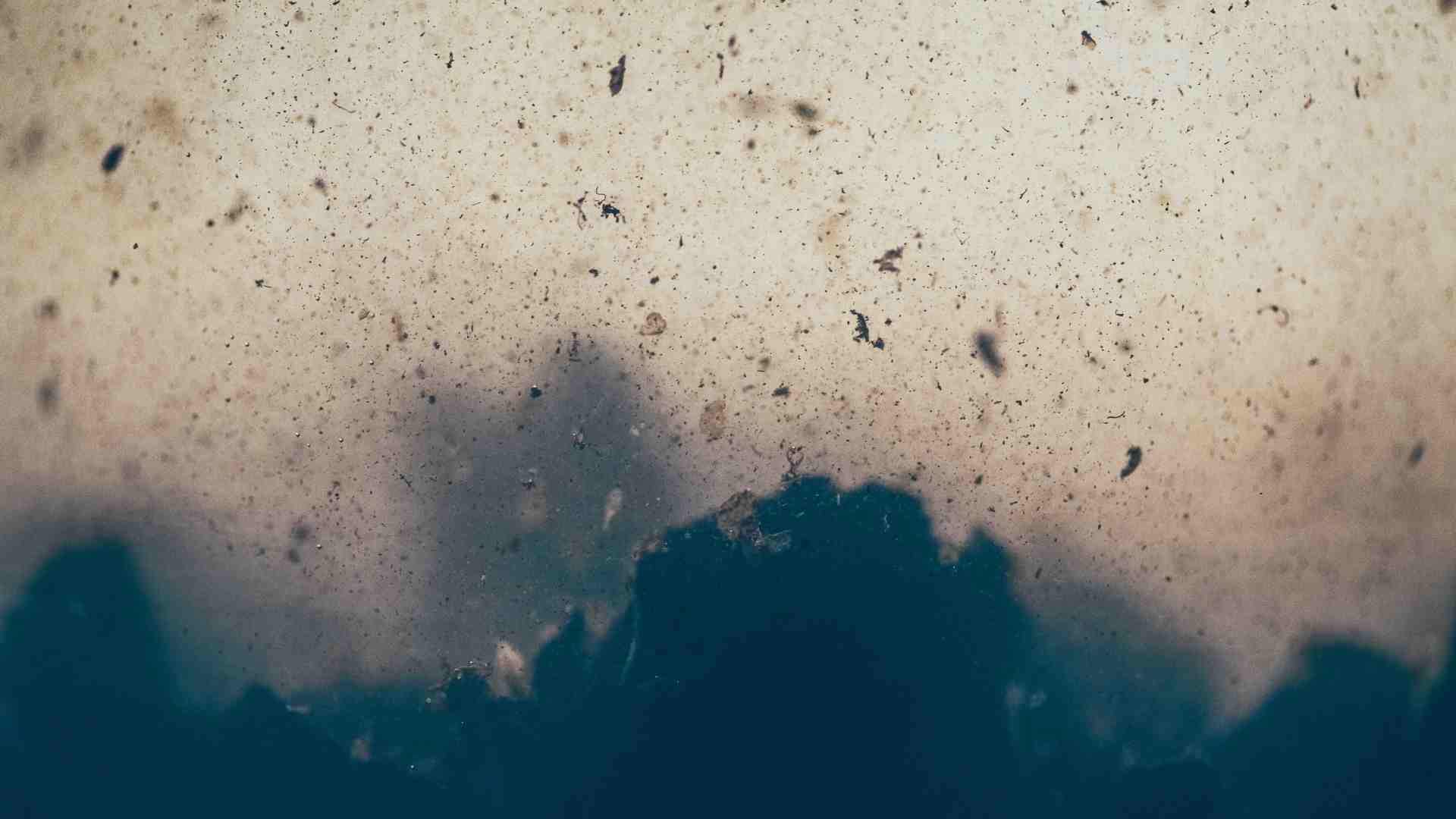 Immagine di Un batterio in grado di peggiorare la prognosi nel cancro del colon retto