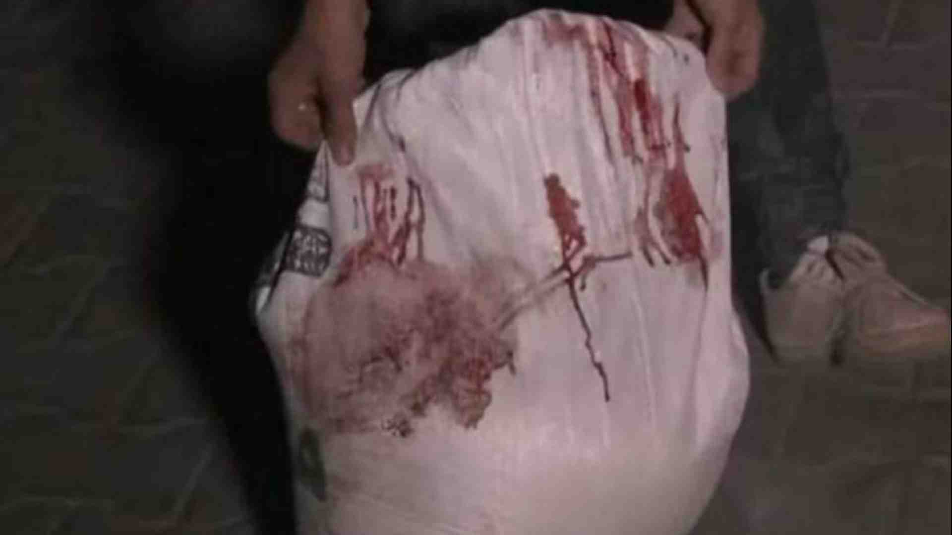Immagine di La dignità negata in un sacco di farina insanguinato a Gaza