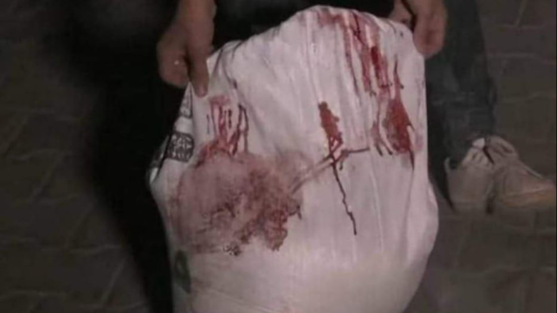 Immagine di La dignità negata in un sacco di farina insanguinato a Gaza