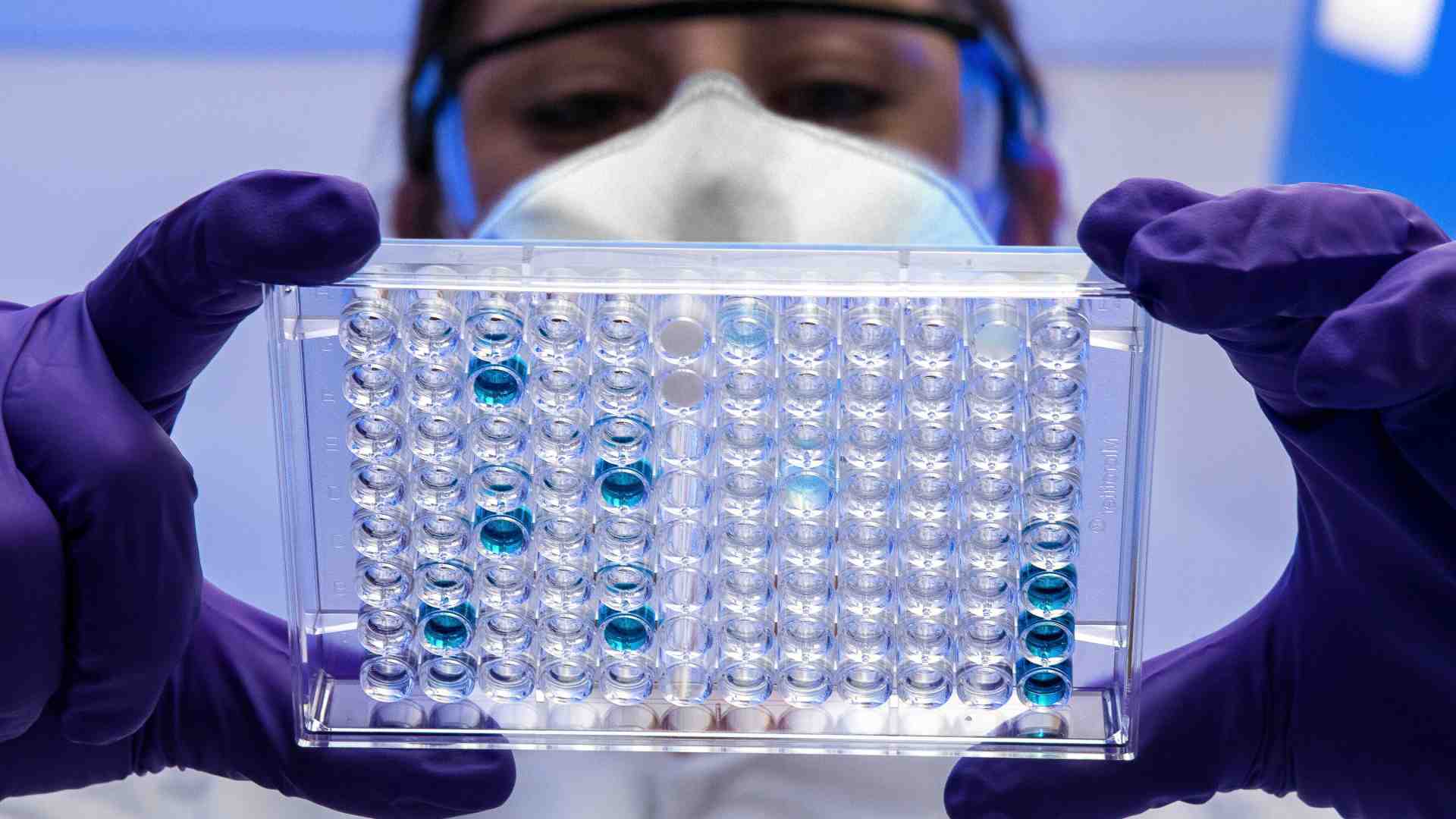 Immagine di I virus e lo stress: come il viroma influenza il comportamento umano