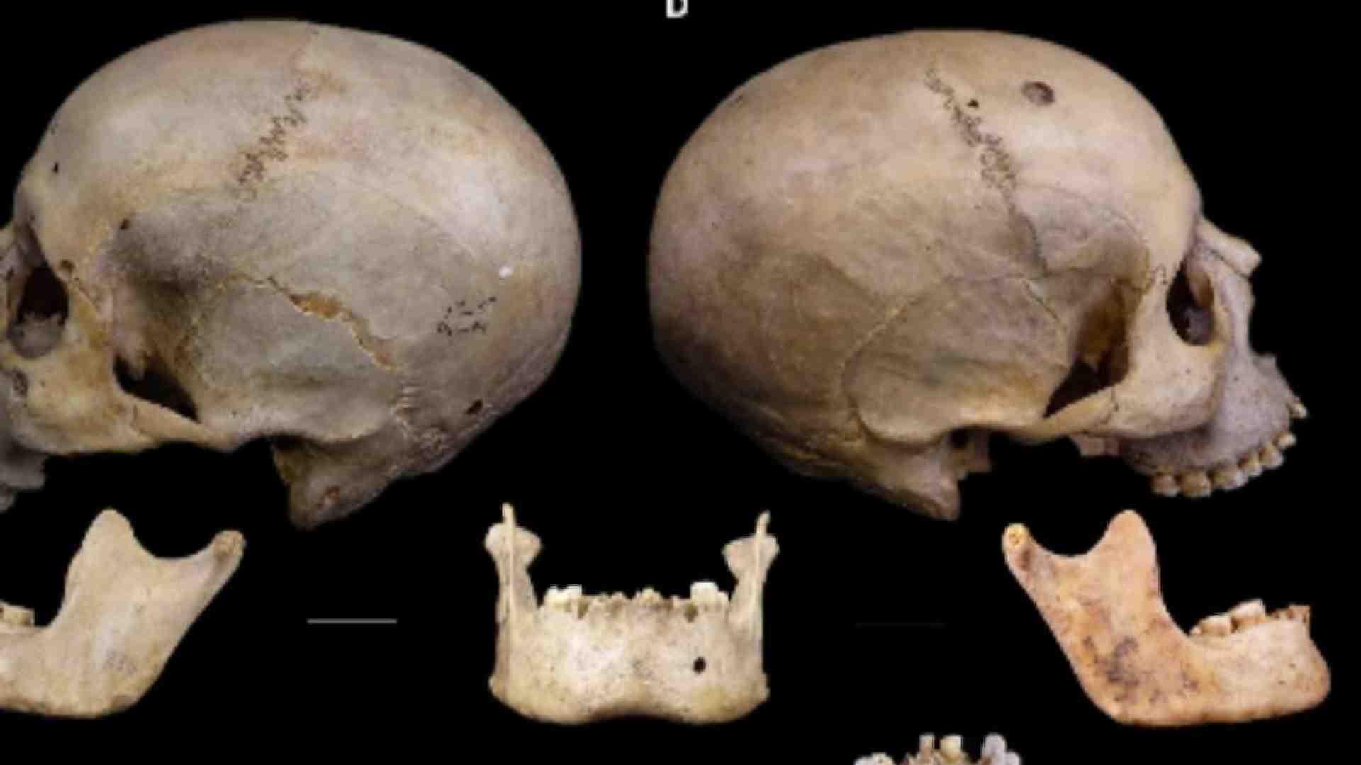 Immagine di Il cancro era conosciuto nell'antichità e gli Egizi sapevano anche curarlo