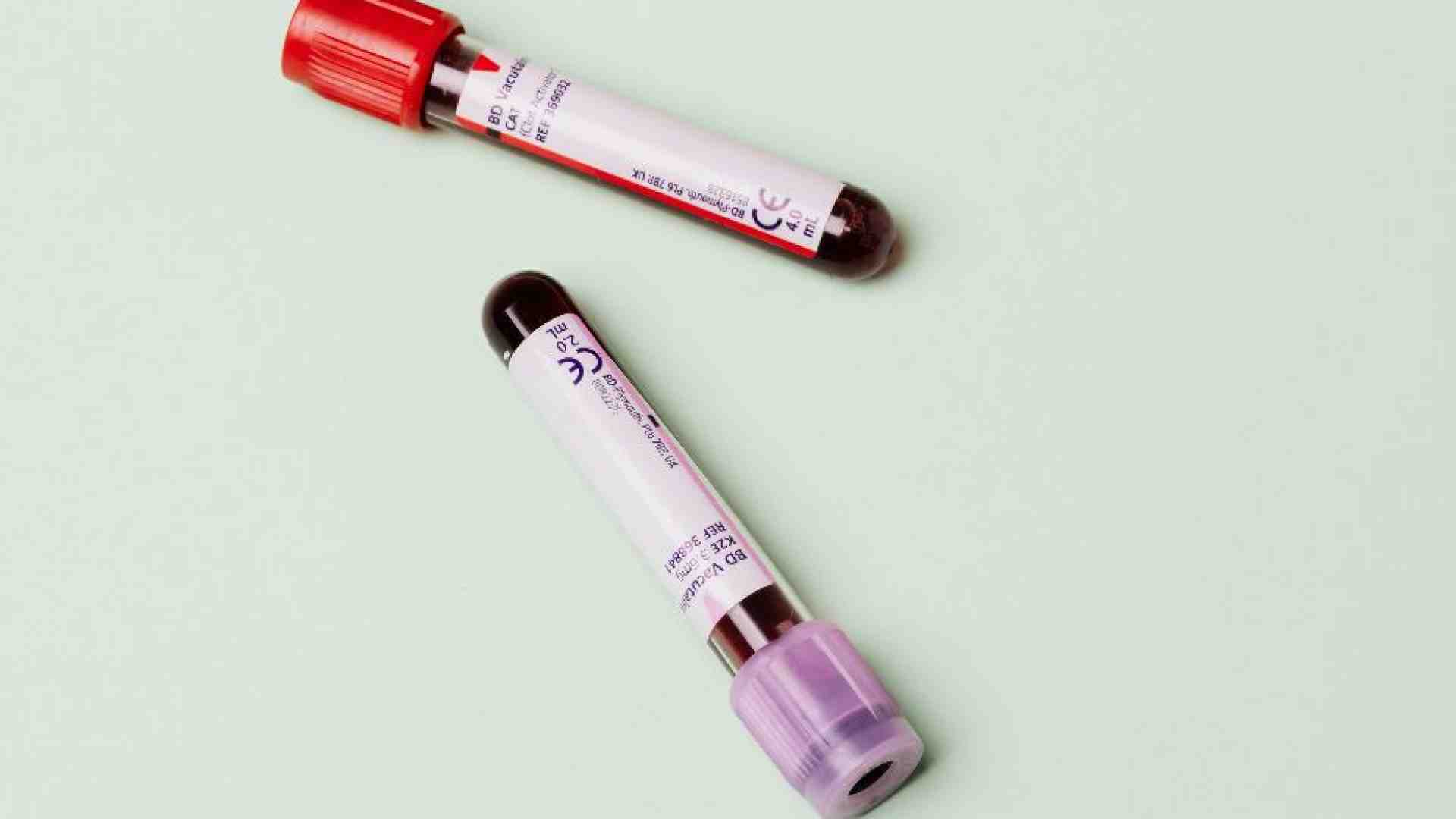 Immagine di «Donazioni di sangue e plasma, mancano i medici per raccoglierle»
