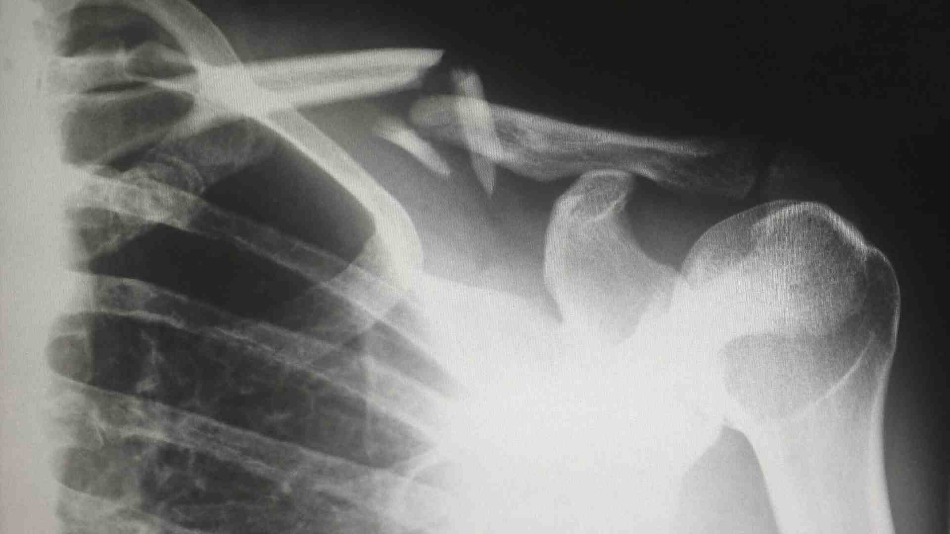 Immagine di Il dolore fisico, un problema di genere
