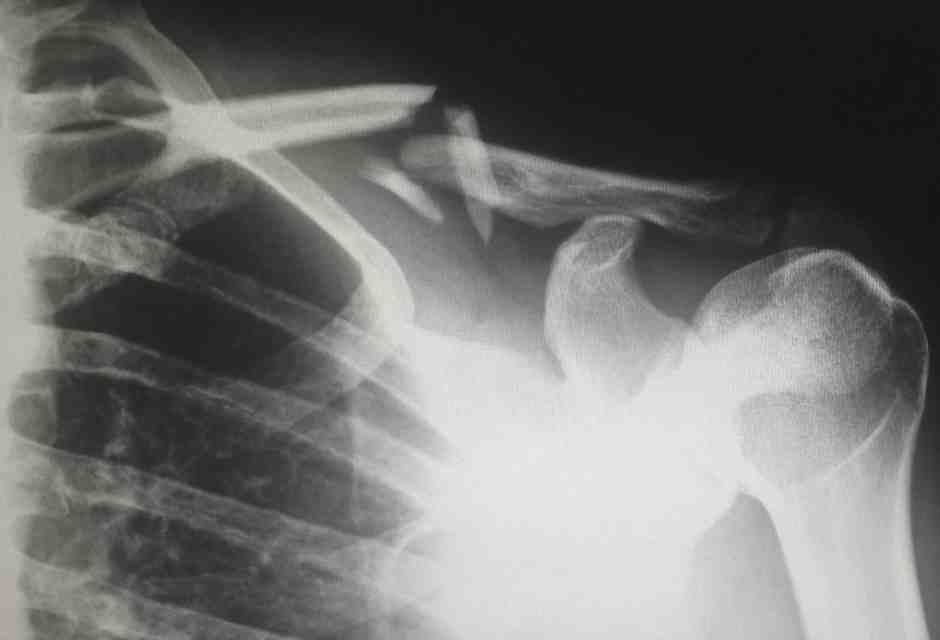 Il dolore fisico, un problema di genere