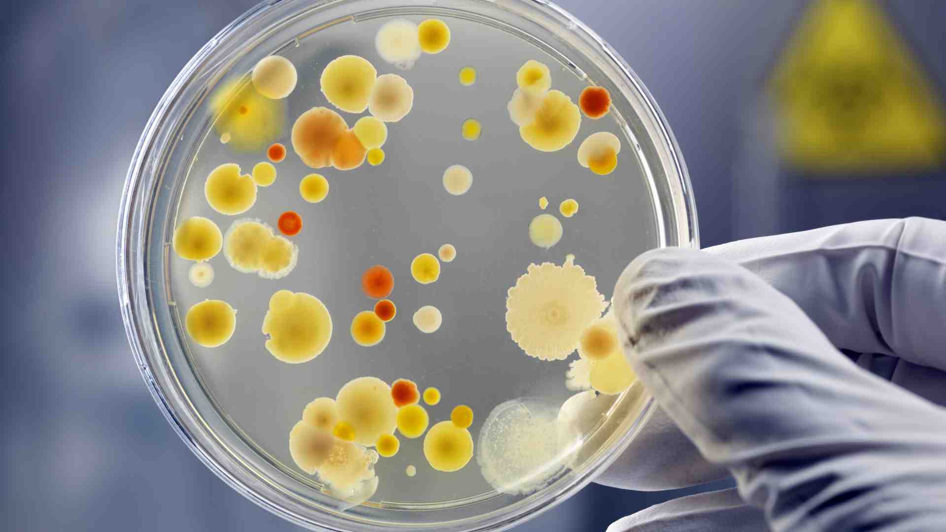 Immagine di La nostra "savana interiore": come combattere i nostri parassiti usando i loro competitori