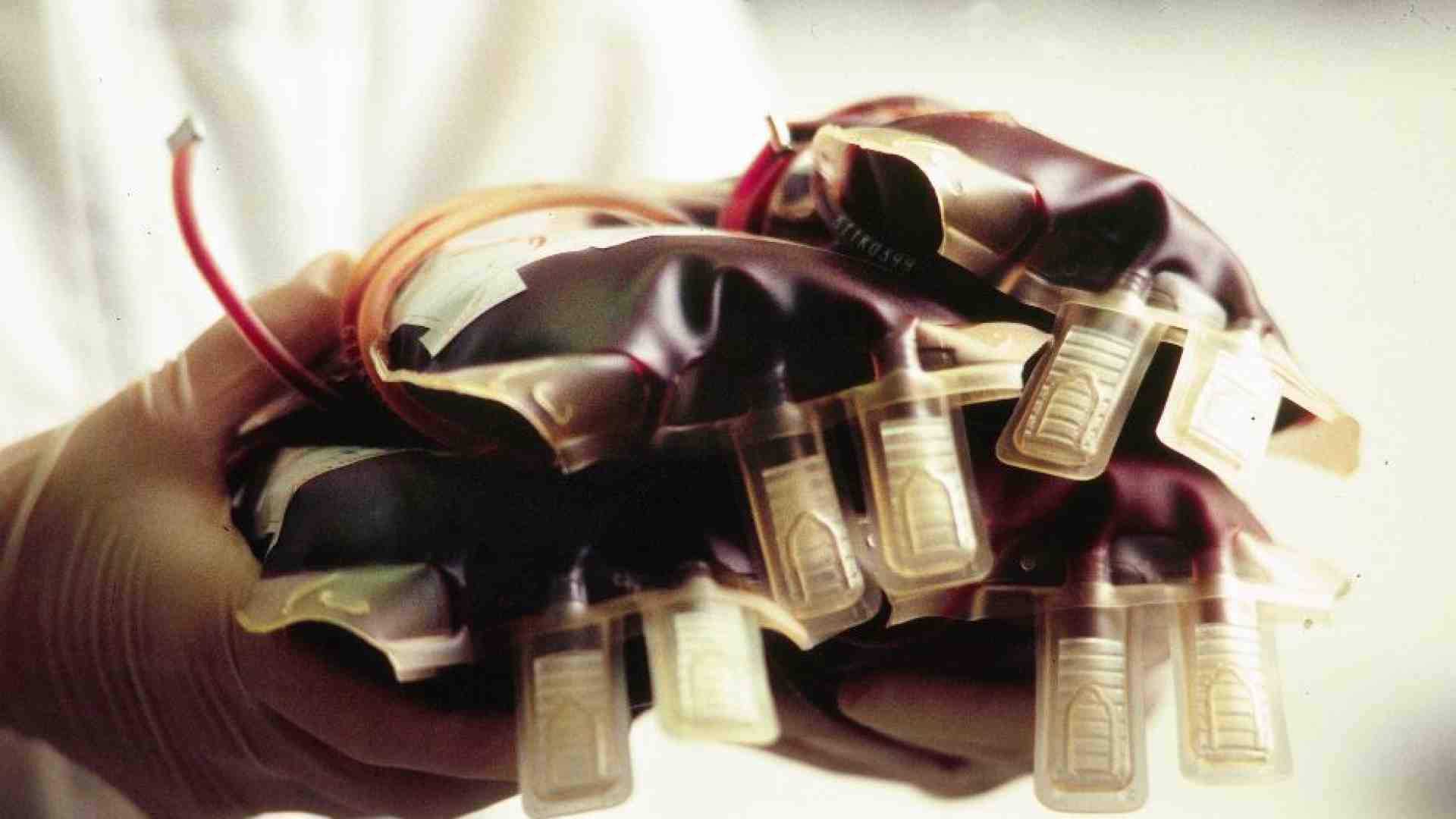 Immagine di Sempre più giovani donano sangue, ma mancano medici che lo raccolgano